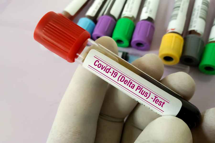 Qué es la variante Delta plus del coronavirus