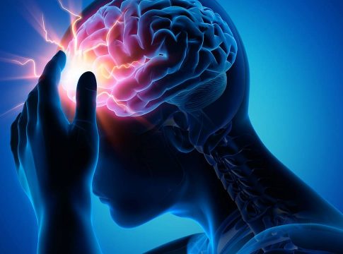 Qué es un ictus isquémico Qué es un ictus isquémico