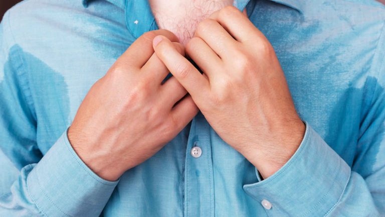 Trucos para mantener a raya el exceso de sudor