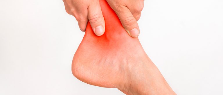 Cómo curar un esguince
