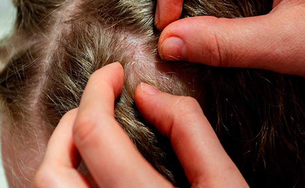 Medicamentos para atender el problema