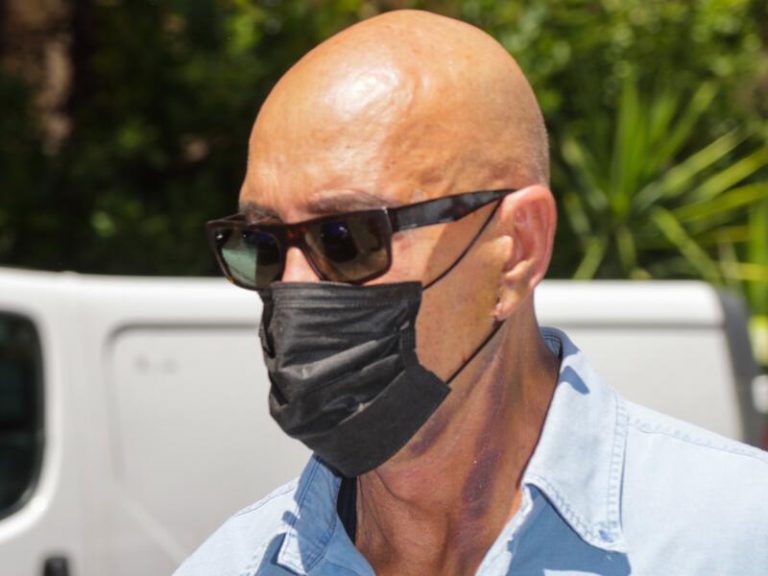 Kiko Matamoros, con el rostro amoratado, acude a revisión de sus últimos retoques estéticos
