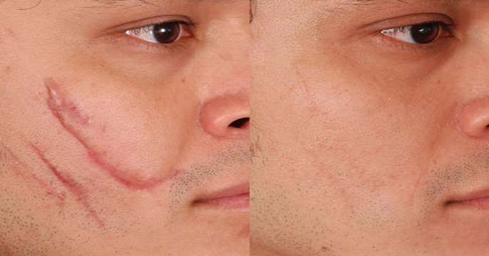 Opciones naturales que debes probar para ocultar imperfecciones 