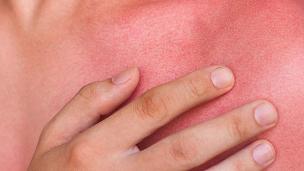 Lesiones o inflamaciones graves