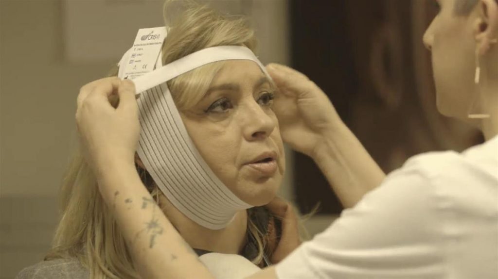 Primer retoque que se realizó Carmen Borrego