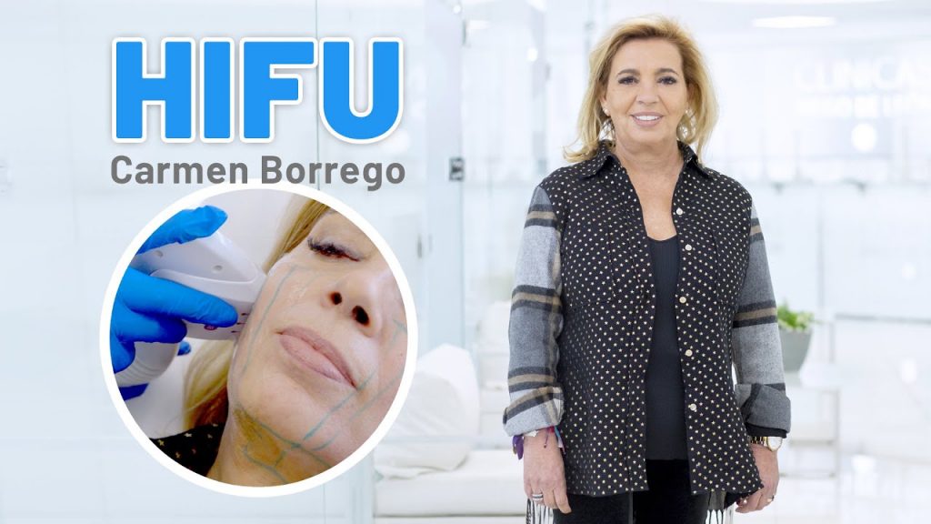 Último procedimiento médico estético