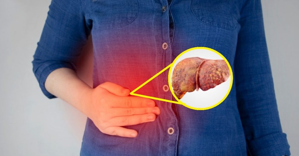 Problemas en el hígado o el páncreas por causa del alcohol