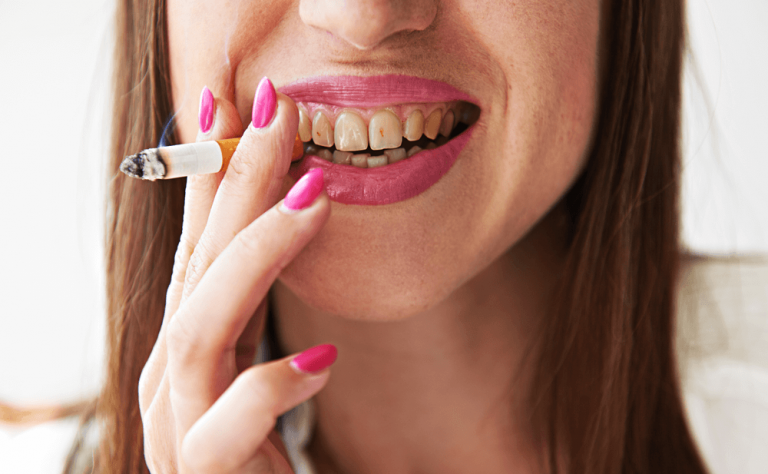 Cómo eliminar las manchas amarillas en los dientes por el tabaco