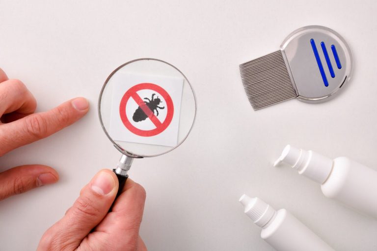 Cómo saber si tienes piojos