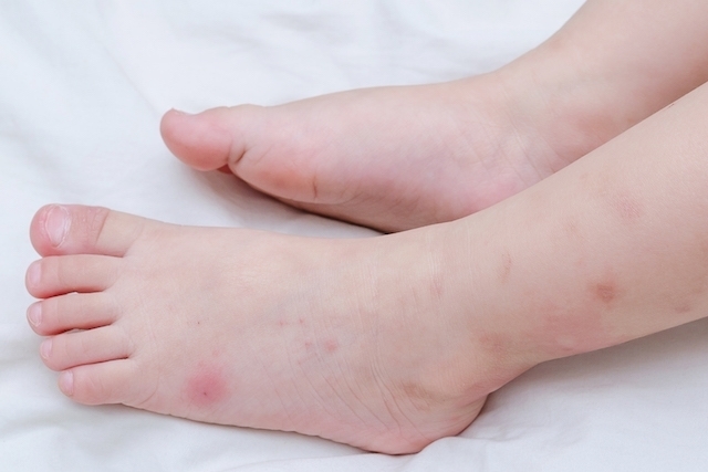 Lo que ha ocurrido últimamente con las picadas