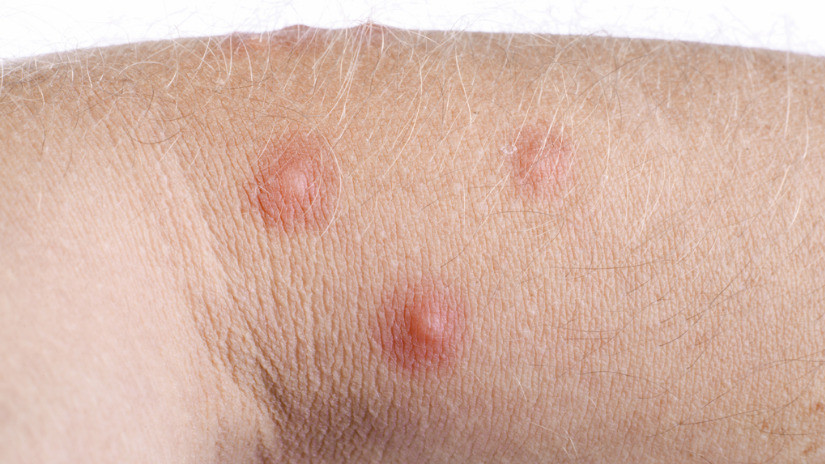 ¿Qué es un mosquito?