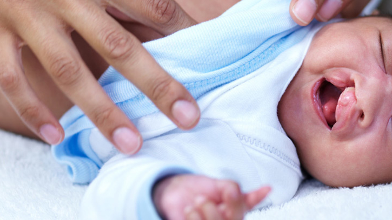 Qué es el labio leporino 1 Qué es el labio leporino