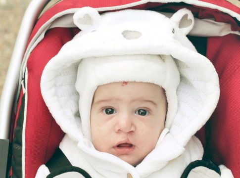 Qué es el labio leporino Qué es el labio leporino