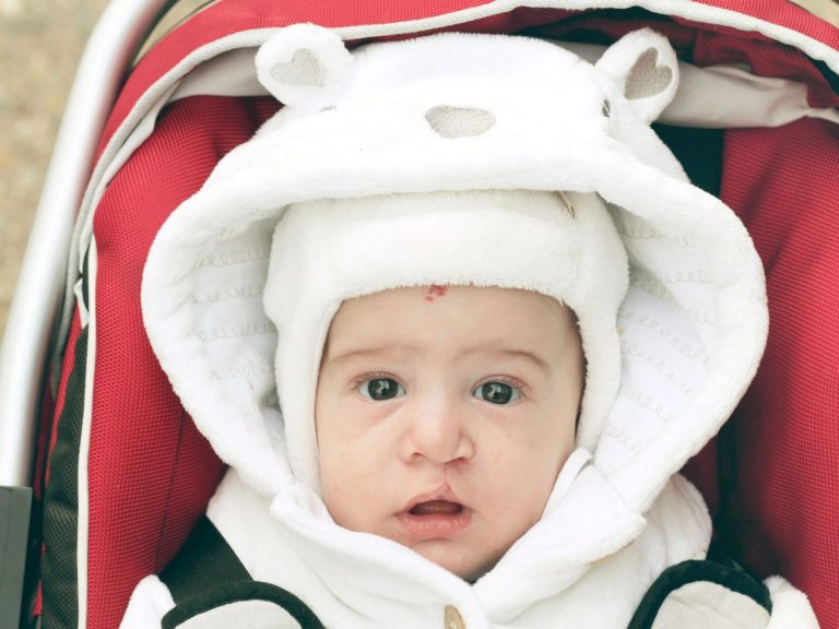 Qué es el labio leporino