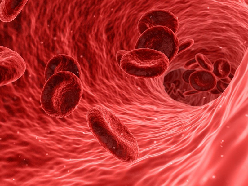 Qué es el síndrome de fuga capilar 1 Qué es el síndrome de fuga capilar