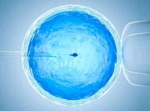 Qué es la fecundación in vitro Qué es la fecundación in vitro