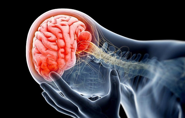 Qué es una isquemia