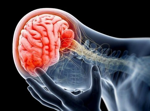 Qué es una isquemia Qué es una isquemia