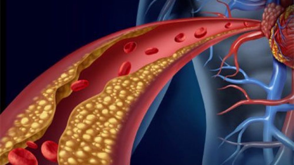 Regula el colesterol y te cuidas de una presión sanguínea comiendo ajo