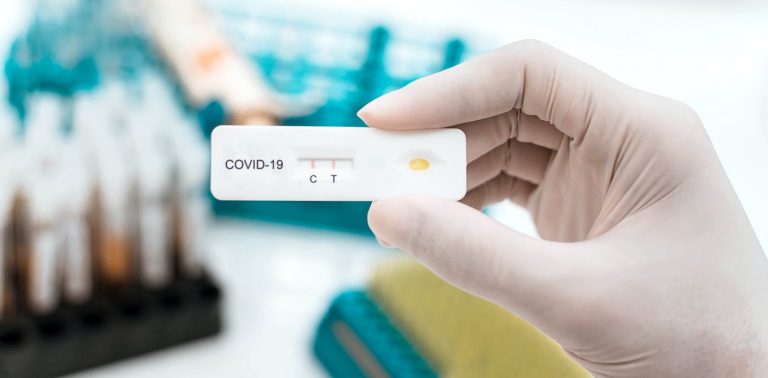 Test de antígenos o de anticuerpos: para qué vale cada uno
