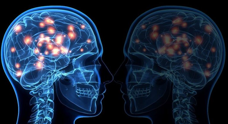 Cada cinco minutos una persona es diagnosticada de esclerosis múltiple en el mundo