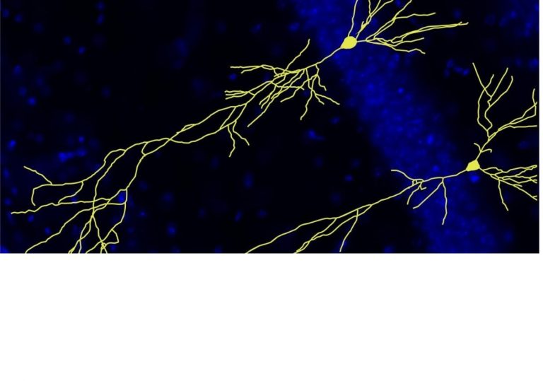 Un método computacional permite predecir la estructura tridimensional de las proteínas