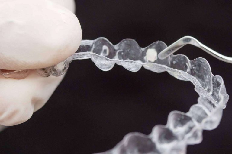 Gran variedad de tratamientos en clínica dental Murcia Vélez & Lozano