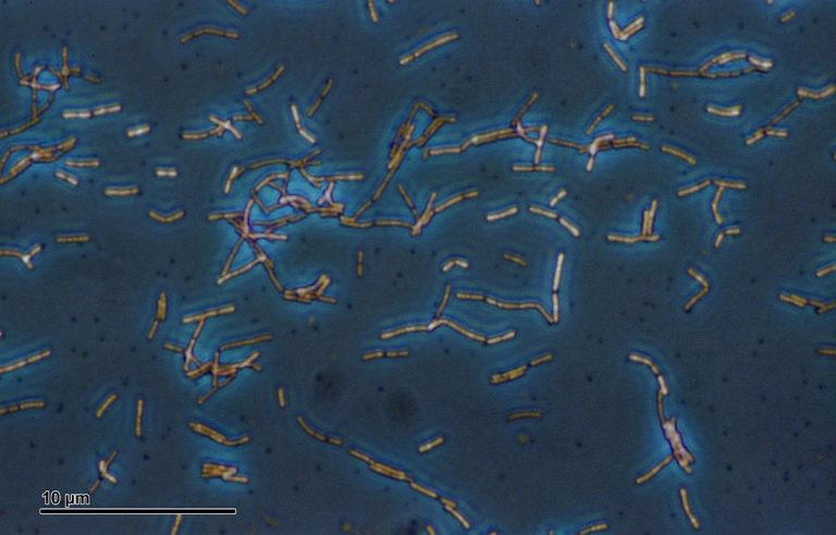 Investigadores del CSIC describen las bacterias que forman la microbiota de varios anisákidos
