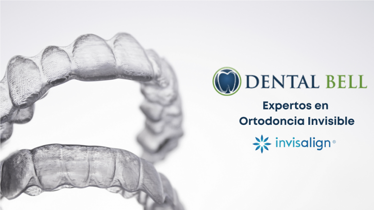 Ortodoncia invisible Invisalign en Sevilla