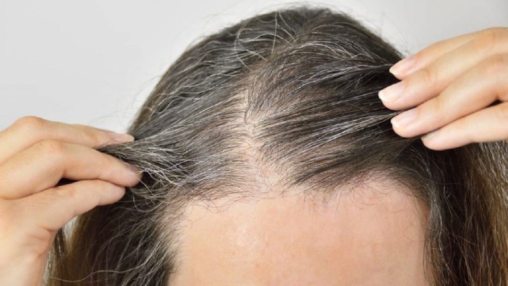 ¿Realmente se pueden prevenir canas antes de una determinada edad?