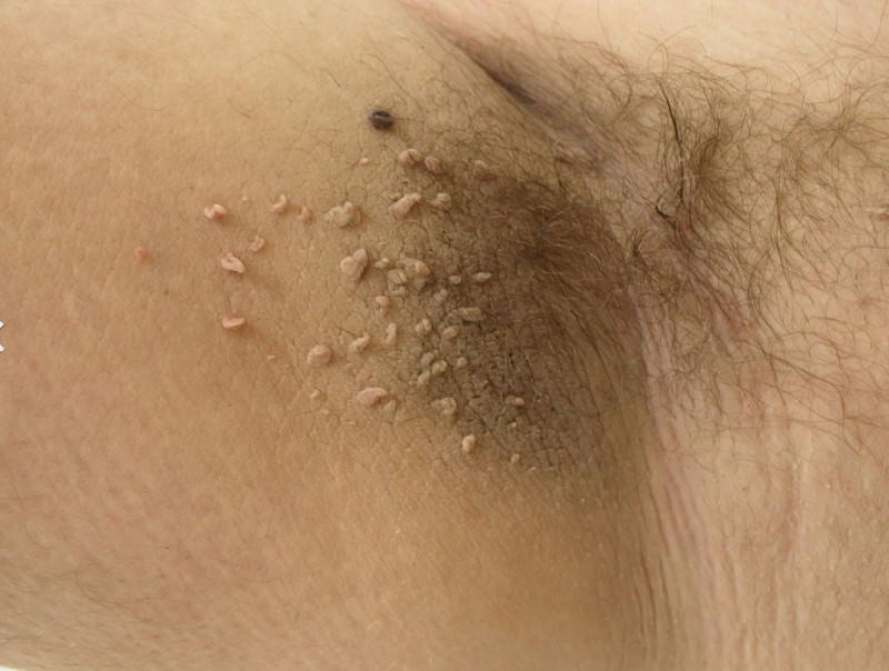 ¿Cómo se contagia?