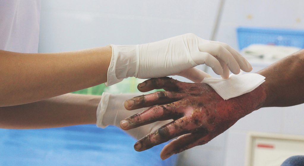 Lesiones más graves