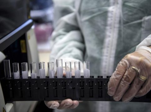 Descubren que la proteína p53 regula la producción de glucosa