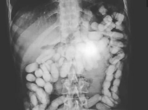 Detenido en el aeropuerto de Palma un 'mulero' con 50 cilindros de cocaína