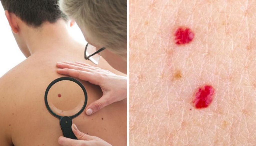 No comiences a preocuparte