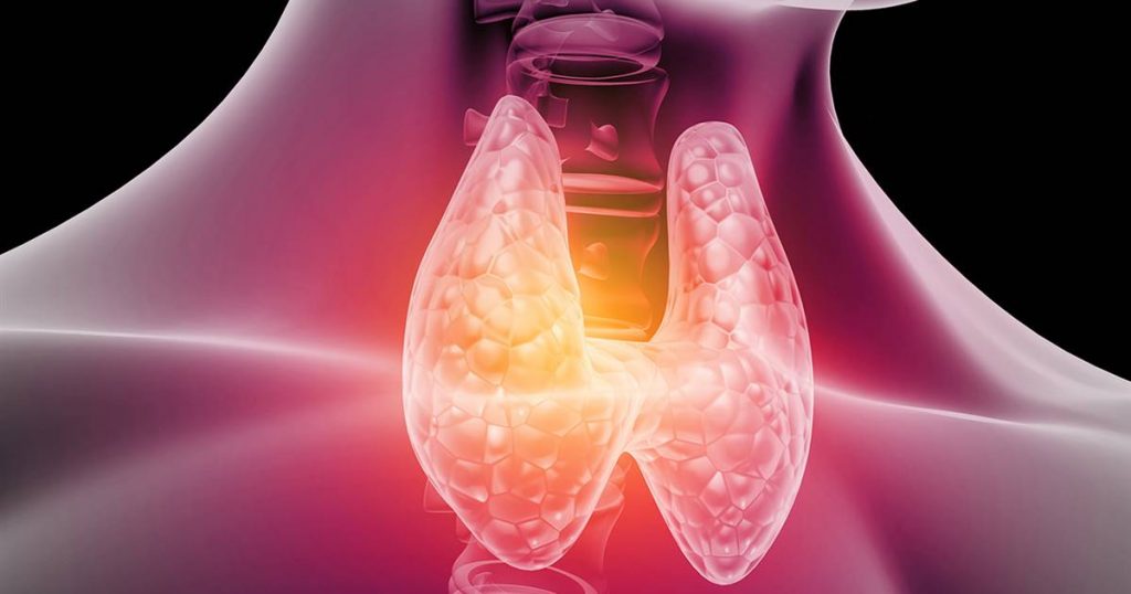 ¿Qué es el hipotiroidismo?