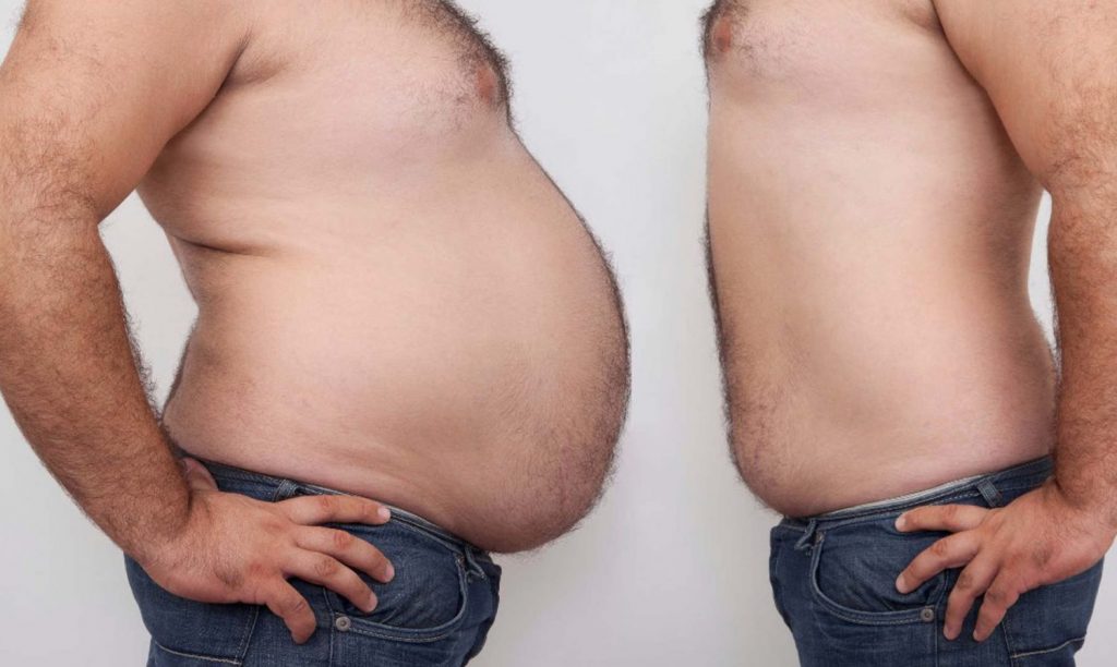 ¿Qué relación tiene el hipertiroidismo con el peso?