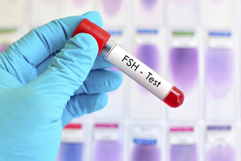 Qué es el FSH en un análisis de sangre