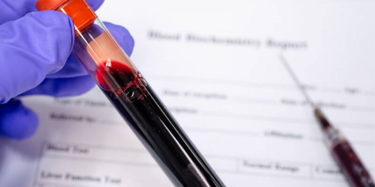 Qué es el RDW en la sangre