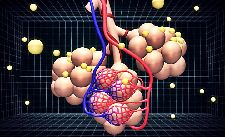 Qué es la silicosis