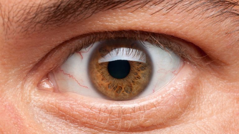 Qué es la tensión ocular