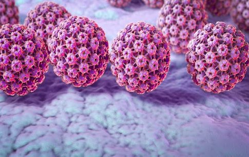 Qué es un papiloma Qué es un papiloma