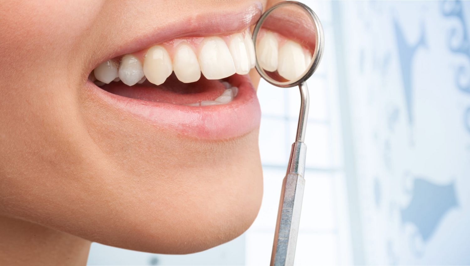 Qué es un raspado dental