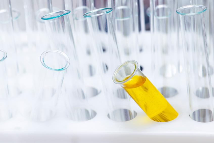 Qué es un sedimento de orina