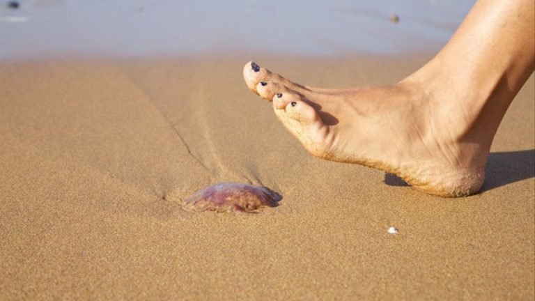 Esto es lo que debes hacer si te pica una medusa