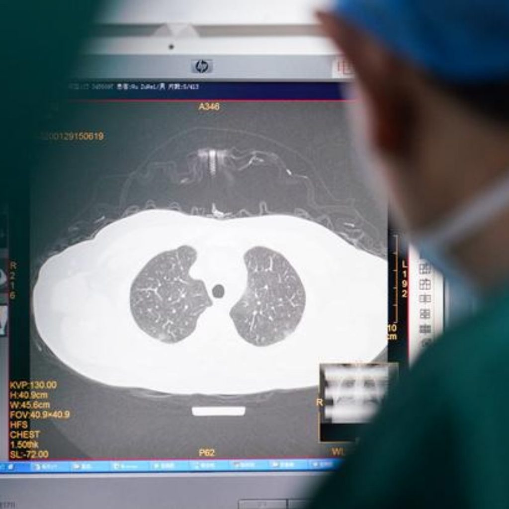 ¿Cómo prevenir las afecciones posteriores al Covid?