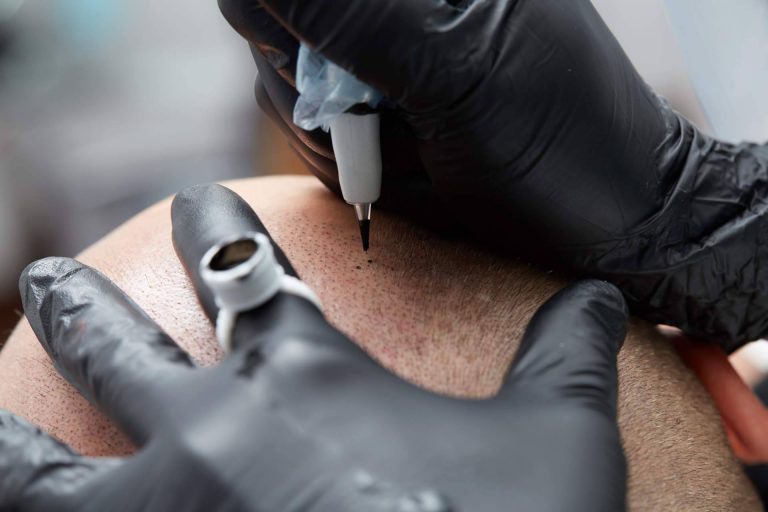 Tricopigmentación para hombres y mujeres con Distrito Wellness Concept