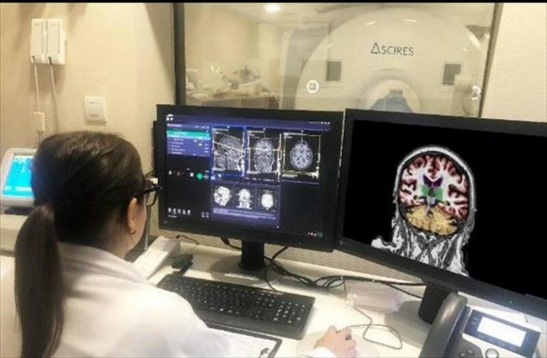 El colesterol impulsa la formación de placas de Alzheimer