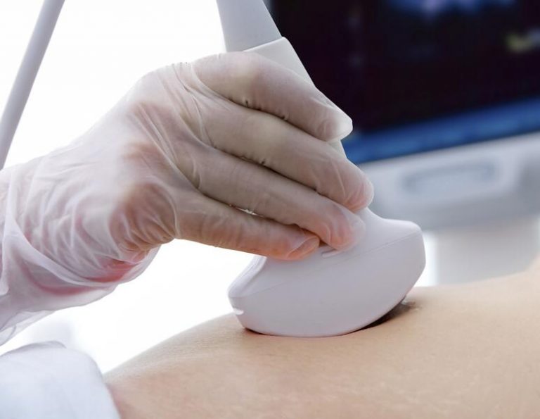 Las interrupciones voluntarias de embarazo descendieron en 2020, hasta 88.269