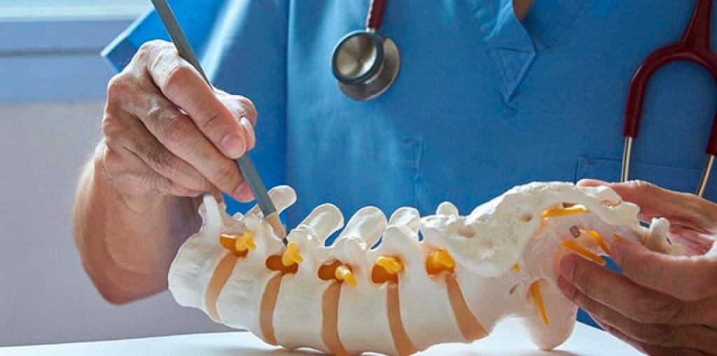 Remedios para aliviar el lumbago 3 ¿Hay medicamentos para atender un lumbago?